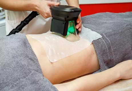 therapist applying cool sculpting treatment