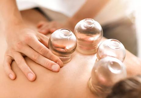 cupping therapy