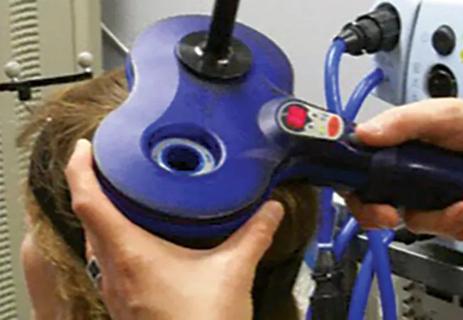 21-NEU-2076655_transcranial-magnetic-stimulation_650x450