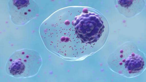 Multiple myeloma cells