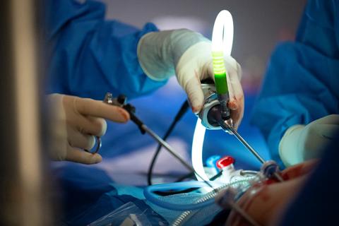 Closeup of physician performing bariatric surgery