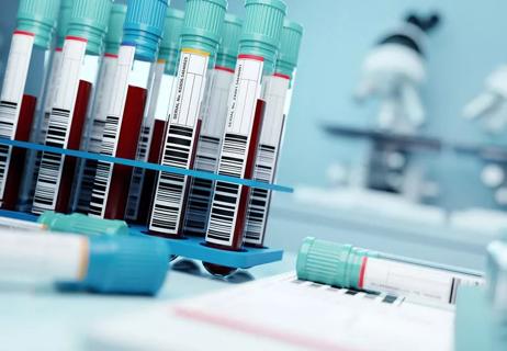 Blood test