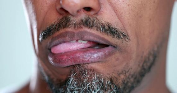Grimacing person pushing tongue out