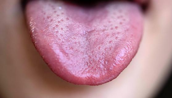 Person sticking out tongue showing taste buds