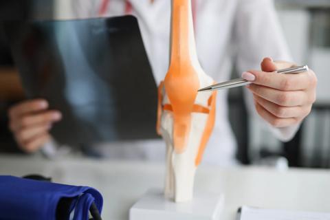 Healthcare provider holding X-ray in one hand, pointing to a model of a bone and joint with the other