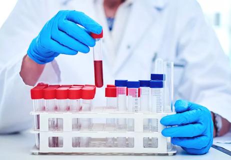 blood being tested in lab