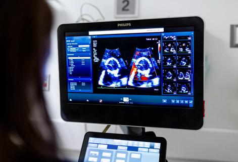 Echocardiogram