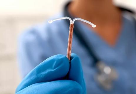 Physician hold a copper IUD in hand showing how small it is.