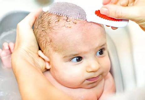 gently removing cradle cap from baby's head with comb and moisturizer
