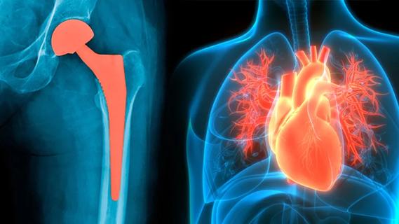 Hip replacement and heart illustration