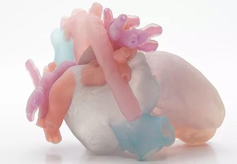 photo of 3D-printed pediatric heart with congenital anomalies