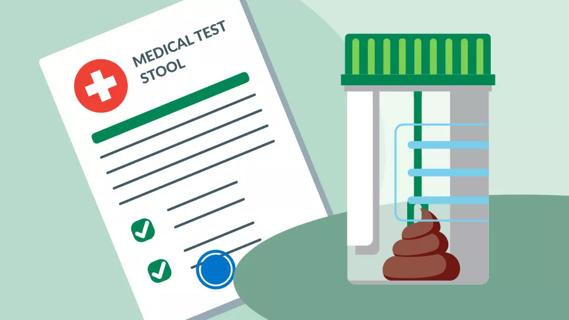 At-home stool test sample and report generated