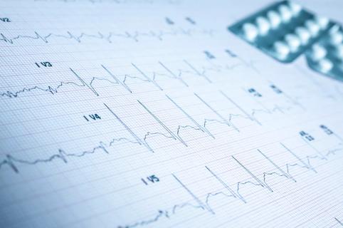 Heart rate on medical print out and pills