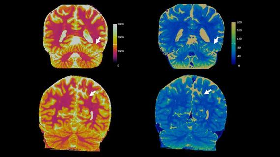 four colored brain scans against black background