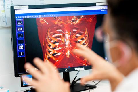 21-ORT-2113558-Thoracic-Oncology-and-Orthopaedics-CQD