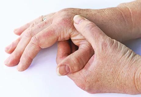 man with painful joints in hand