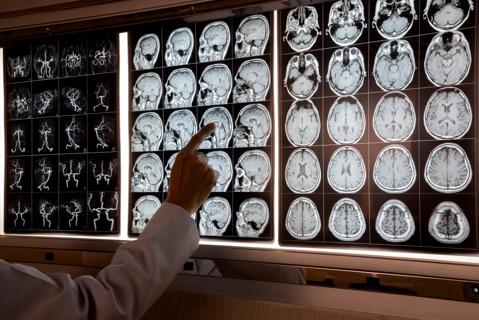 Doctor pointing at MRI of human brain