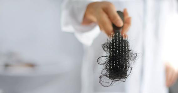 Hair Loss in Women: When Should You Worry?
