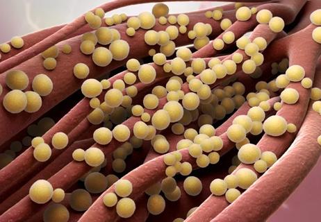 S. Aureus bacteria