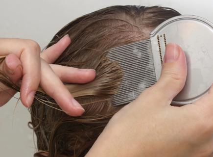 Hands combing wet hair with head lice comb