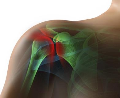 Rotator cuff