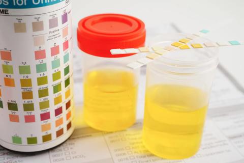 An FSH at home urine test kit