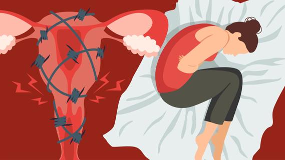 Woman doubled over in pain lying in bed, with oversized uterus covered in barbed wire