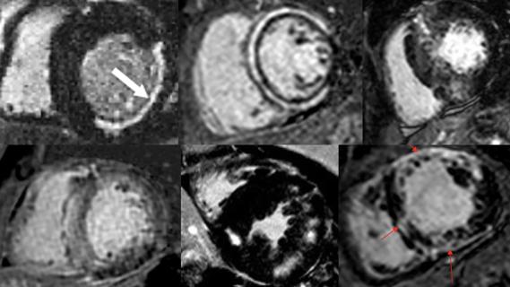 six panels of black-and-white heart imaging studies grouped in a rectangle
