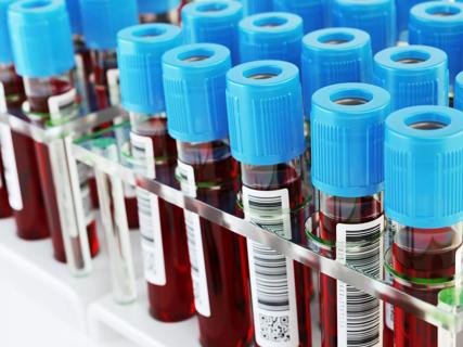 Blood vials