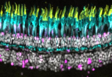 22-EYE-3049477 New findings in retinal regeneration-Perkins-650&#215;450-4