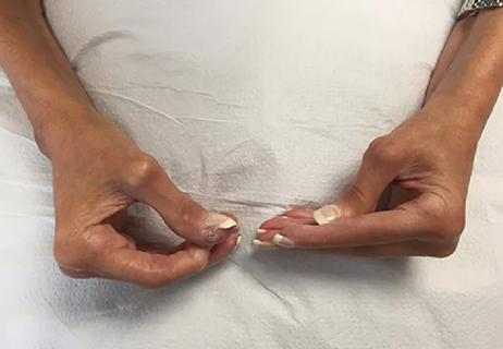 20-RHE-186196-ConcurrentAnit-PM-SCL-Myositis-hero_650x450