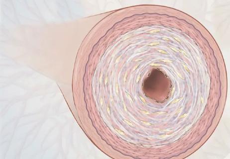 small vessel pathology in systemic sclerosis