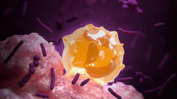 Medical illustration of a tumor and bacteria.