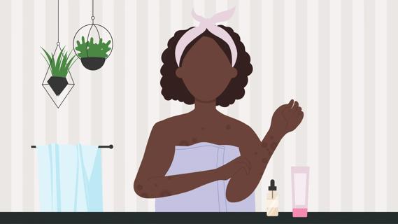 Person with darker skin tone, wearing a towel in their bathroom, with eczema rash on their skin