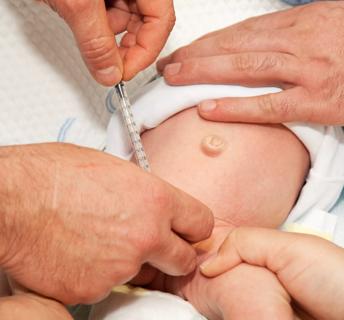 Medical procedure being performed on a baby boy