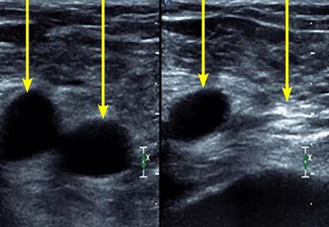 650&#215;450 serhal_abdominalpain