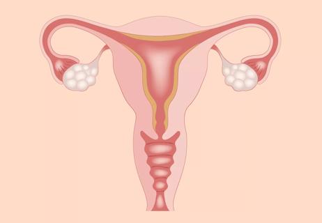 What Risks Are Associated with a Ruptured Ovarian Cyst?