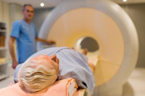 PSMA PET CT
