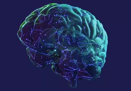 20-NEU-1931313-Parkinsons-brain-650&#215;450