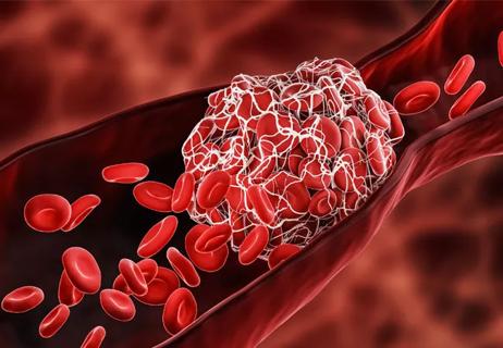 illustrated platelets forming a clot in a blood vessel