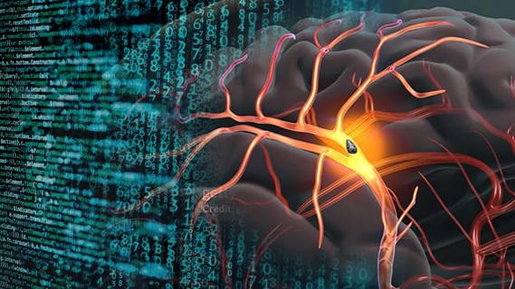 data strings on computer screen merged with illustration of a brain clot