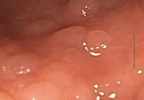 16-ddi-2168-studded-rectum-cqd-650&#215;450