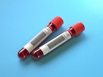 Blood vials on blue background