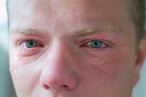 Person crying, with red, swollen eyes, staring straight at the viewer