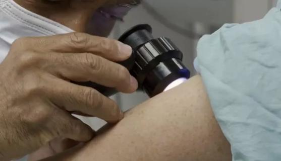 Doctor examining patient's skin
