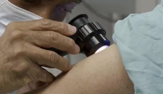 Doctor examining patient's skin