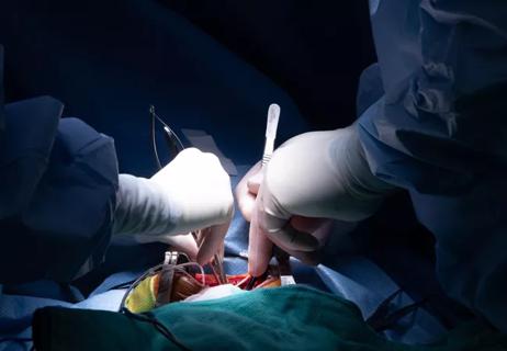 23-HVI-3728608_operative-field-in-surgery_650x450