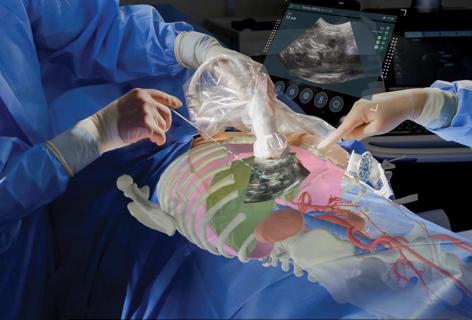 Surgical procedure using innovative technology such as 3D imaging.