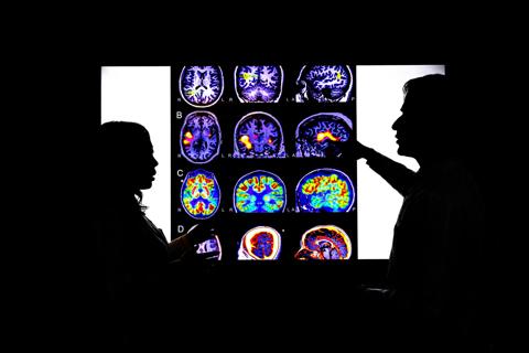 19-NEU-6526_epilepsy-brain_CQD_650x450_