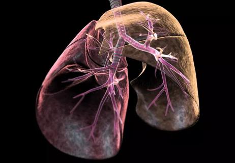 21-HVI-2595511_lungs_650x450